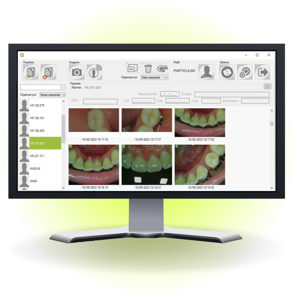 programa awbook acompanha a camera intraoral intracam h5