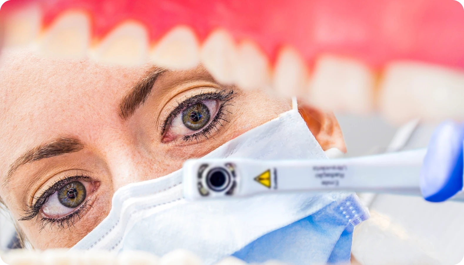 Vista de dentro da boca de um paciente, com foco no rosto de uma dentista usando máscara e segurando uma câmera intraoral. Os dentes desfocados no primeiro plano emolduram a imagem, destacando a perspectiva do exame odontológico.